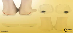 درمان و کنترل پای پرانتزی با استفاده از کفی طبی